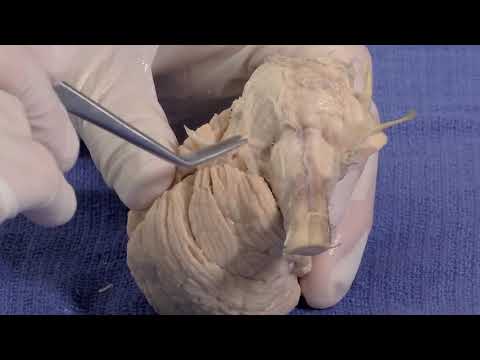 The Cerebellum  Neuroanatomy Video Lab   Brain Dissections