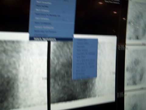 Jun 05 2009 Xeleris from RA1000