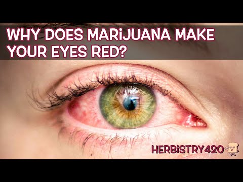 Why Does Weed Make Your Eyes Red: 4 Facts and Fixes