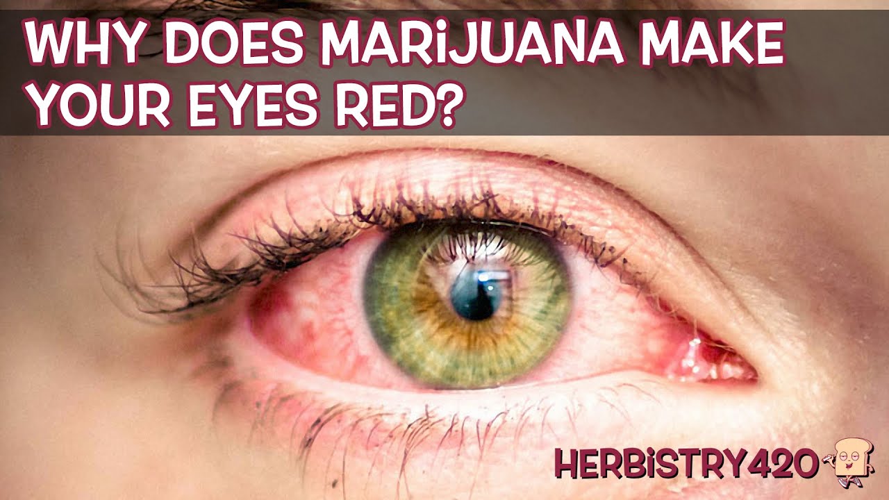 Why Does Weed Make Your Eyes Red: 4 Facts and Fixes