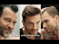 TVN Turbo Mix Reklam I Zapowiedzi 04 01 2015