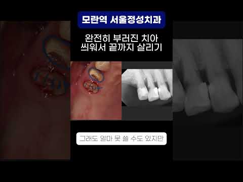 땡큐성형외과 Clips