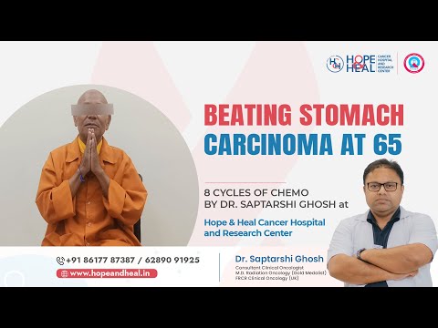 BEAT THE STOMACH CARCINOMA AT 65
