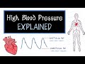 What is High Blood Pressure? (HealthSketch)