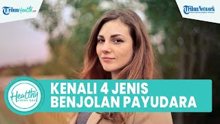 Download lagu Kenali 4 Jenis Benjolan Payudara pada Wanita yang Kerap Diabaikan: Fibroadenoma hingga Lipoma mp3 Download lagu Kenali 4 Jenis Benjolan Payudara pada Wanita yang Kerap Diabaikan: Fibroadenoma hingga Lipoma mp3