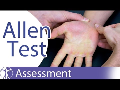 Allen Test⎟Hand Vascularisation