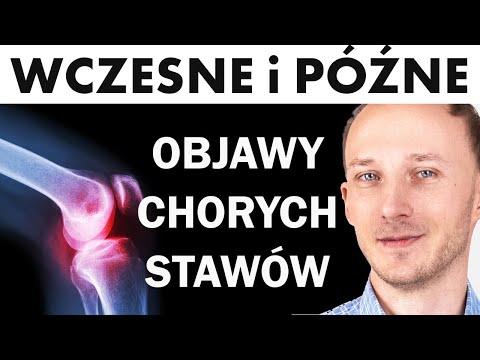 Chore stawy = zagrożony cały organizm ⭕ Jak sobie pomóc?