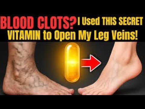 60+  This Vitamin Could Save You from Fatal Blood Clots – Watch Before It’s Deleted!