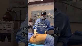 FUPA Liposuction Explained from a Cosmetic Surgeon