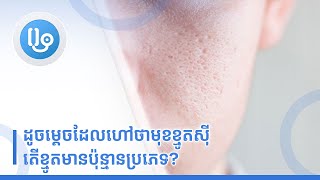 1  ដូចម្តេចដែលហៅថាមុខខ្មូតស៊ី តើខ្មូតមានប៉ុន្មានប្រភេទ
