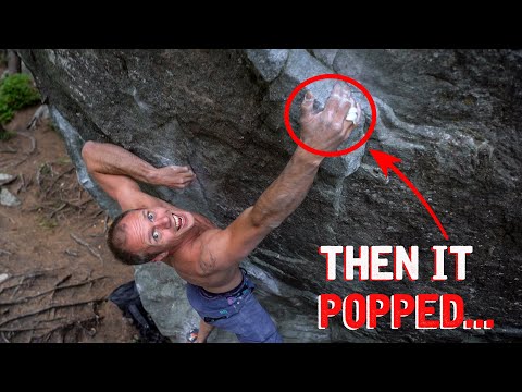 Climbing Finger Injury: Magic Wood BITES Back