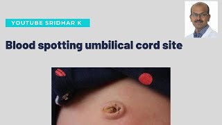 What to do if there is blood spotting at umbilical