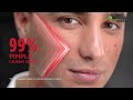 Garnier Men AcnoFight Gentle Cleanser Ft Abhishek Sharma