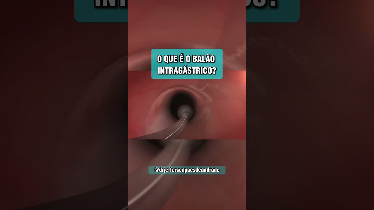 Jefferson Paes De Andrade-46