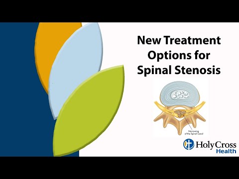 Dr. William Porter McRoberts Discusses Spinal Stenosis: Causes, Symptoms, and Treatments