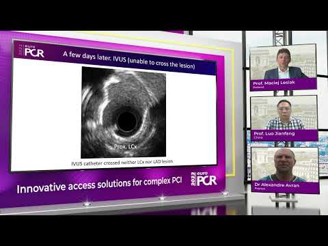 Innovative access solutions for complex PCI - EuroPCR 2022