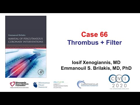 Case 66: PCI Manual - Thrombus, filter, OCT