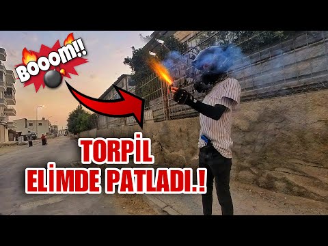 Torpedo Joke Goes Bad! It Exploded in My Hand! #Motovlog