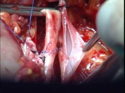 La terapia dellimpotenza Quantum Che pillole aumentare la potenza