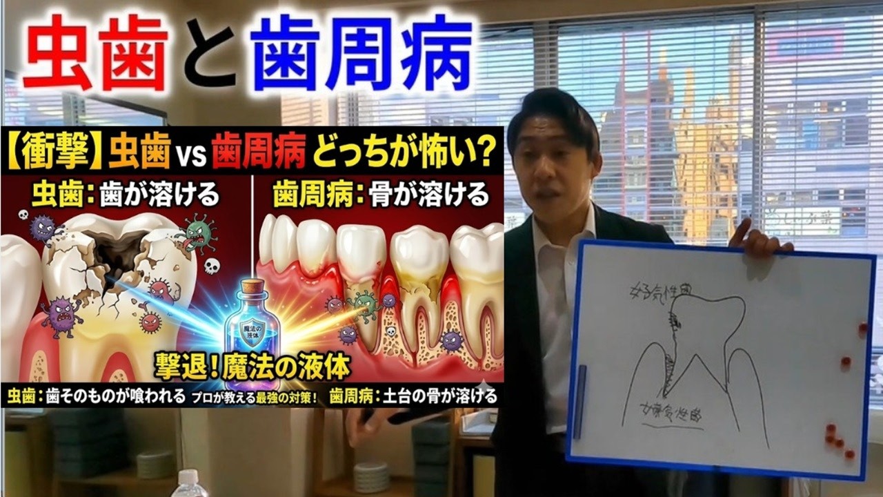 虫歯と歯周病の違いを解説！「実はあなたの歯ぐき、実は溶けてるかもしれません」氷山低層水の酸性が各種好気性細菌を始め、臭いの元となる微生物が逃げ出します。