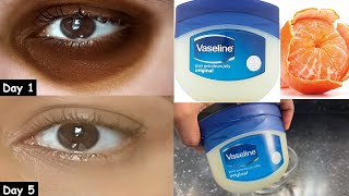 Naturally remove dark circles under eyes in 1 day with Vaseline / Remove dark circles permanently