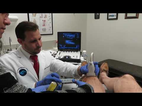 Knee joint aspiration under Ultrasound guidance