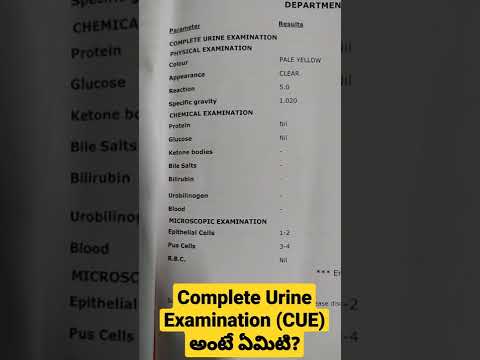 Complete Urine Examination (CUE) అంటే ఏమిటి? Dr Sai Chandra