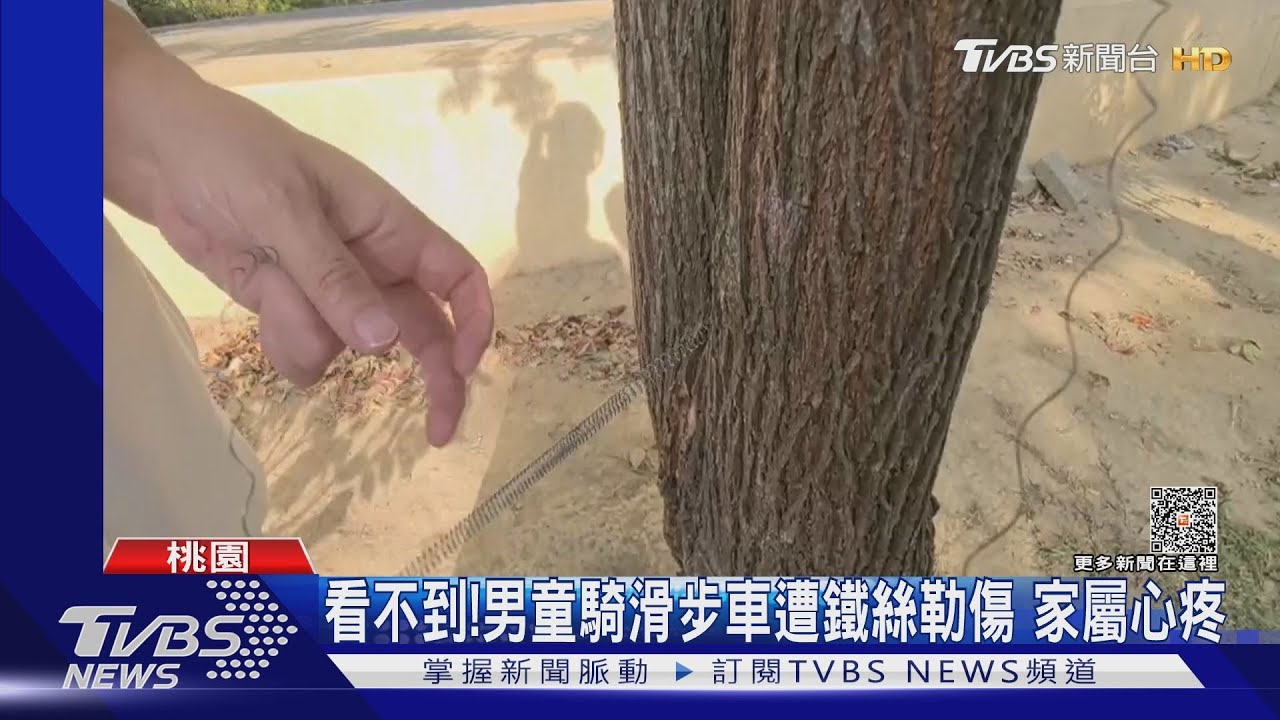 痛!男童至公園玩遭鐵絲勒脖 疑2童惡作劇