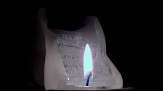 Ludwig Hirsch...Weihnachtstraurigkeit