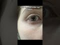 Do you have UNDER EYE WRINKLES?!! #skincare #skincareroutine