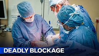 Racing to Fix a Severe Bowel Blockage | Superhospital