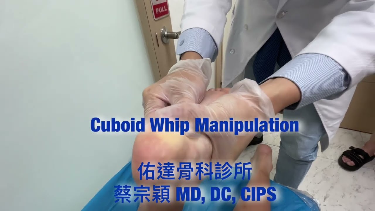 Cuboid Whip Manipulation 骰骨錯位復位【佑達骨科】【蔡宗穎醫師】 - AI健康醫療影片