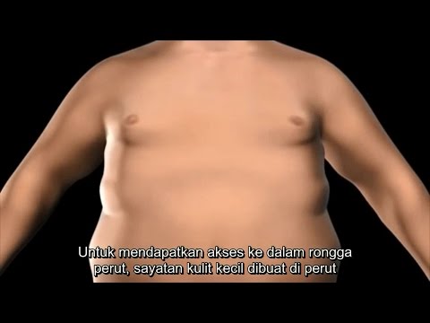 Reduxine membeli dalam Marino Tipis dengan bantuan peroksida