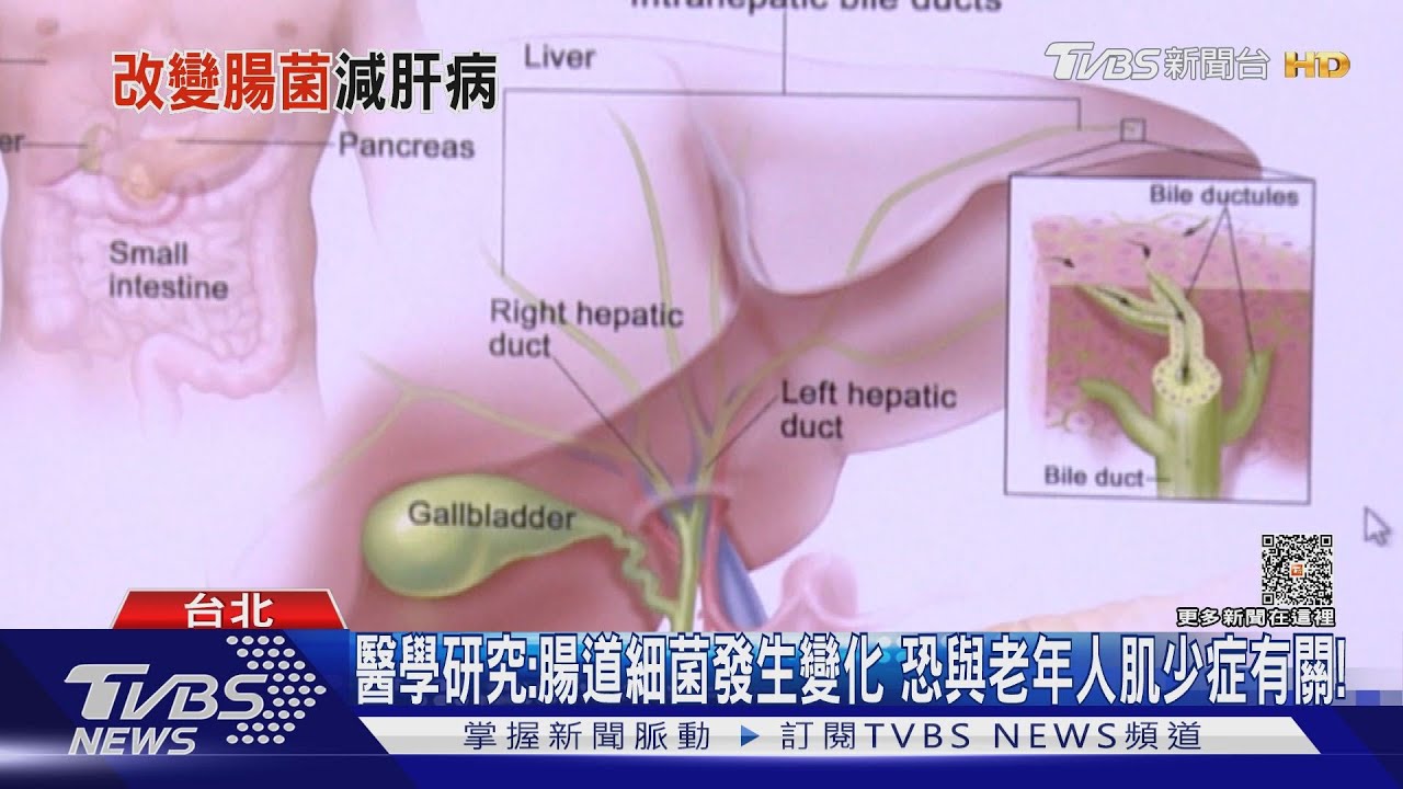 北榮研究!改變「這件事」能減少肝硬化 合併肌少症及併發症