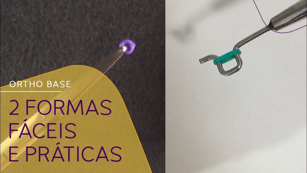 Como colocar a ligadura elástica no aparelho ortodôntico?