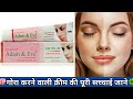 Ham Gora Kaise Bane Adam And Eve Cream Glowingskin Faceglow Beautytips Adanandevecream