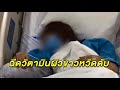ฉีดผิวขาว