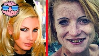 Top 10 Shocking Before And After Drug Use Photos