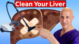 The Absolute Best FOODS to Cleanse and Repair Your LIVER!  Dr. Mandell