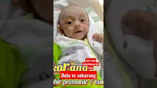 Download lagu lahir prematur 7 bulan 🥺😭😢 aku yang dulu vs sekarang mp3
