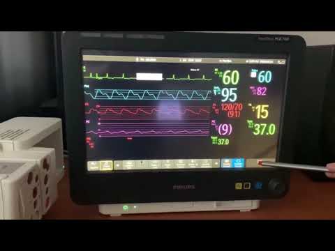 Philips IntelliVue MX700