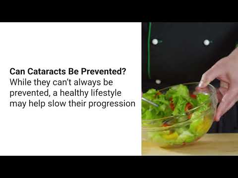 Cataracts Explained Simply