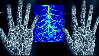 Download lagu Photo-Acoustic Imaging in GI Surgery mp3 Download lagu Photo-Acoustic Imaging in GI Surgery mp3