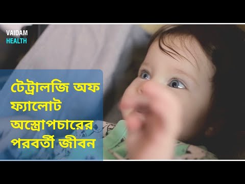 টেট্রালজি অফ ফ্যালোট অস্ত্রোপচারের পরবর্তী জীবন