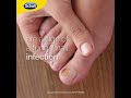 Scholl Fungal Nail Treatment