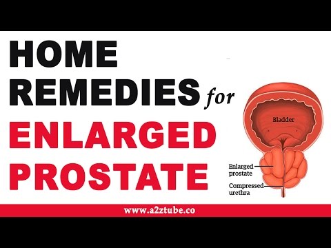 Ob die Schmerzen von Prostatitis passieren Behandlung von Prostatitis, welche Tests