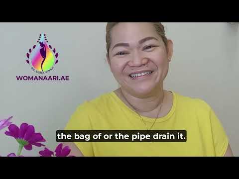 Patient experience: Laparoscopic myomectomy ( fibroid removal) by Dr. Usha Kiran