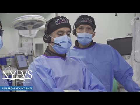 Live Case #4 - Severely Calcified Iliac Artery Intervention