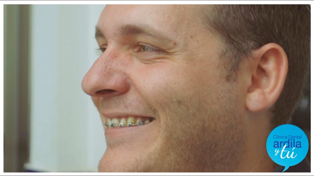 Francisco Javier te cuenta su experiencia