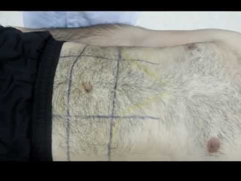 Exame Físico do Abdome: Parte 1 - Inspeção